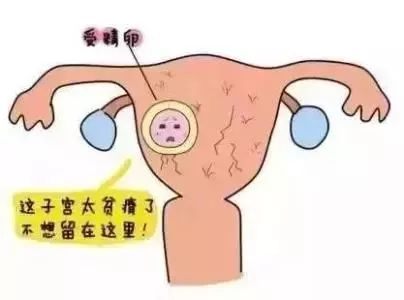 4九圖庫老版本下載,女子懷孕8周找不到胎兒